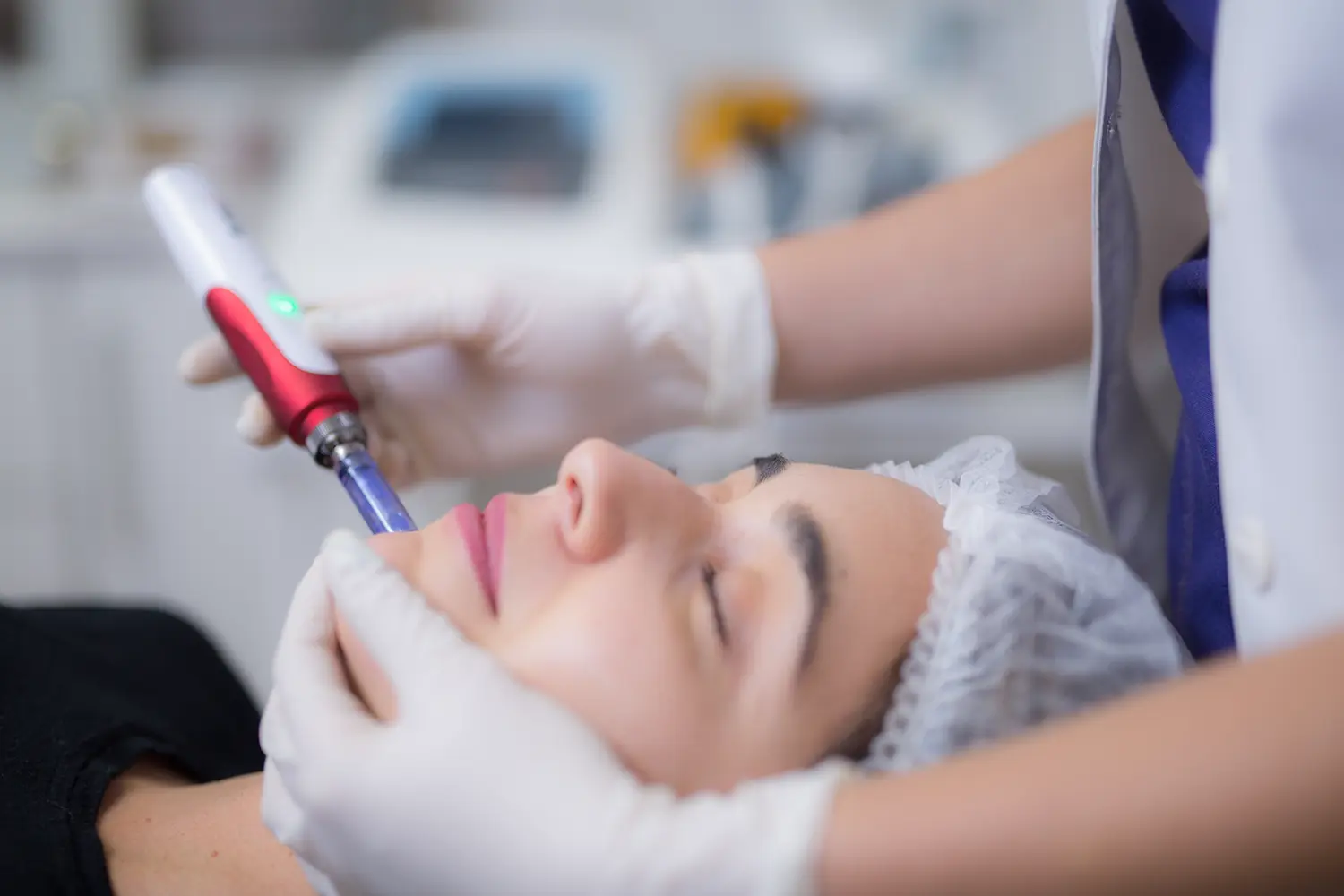 0I2A9330Microneedling Facial Copia