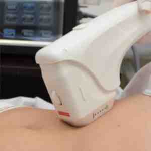 HIFU Corporal Reductivo