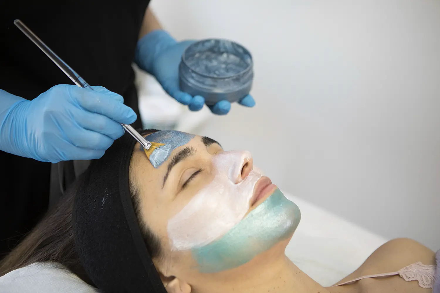 Tratamiento Anti Acne