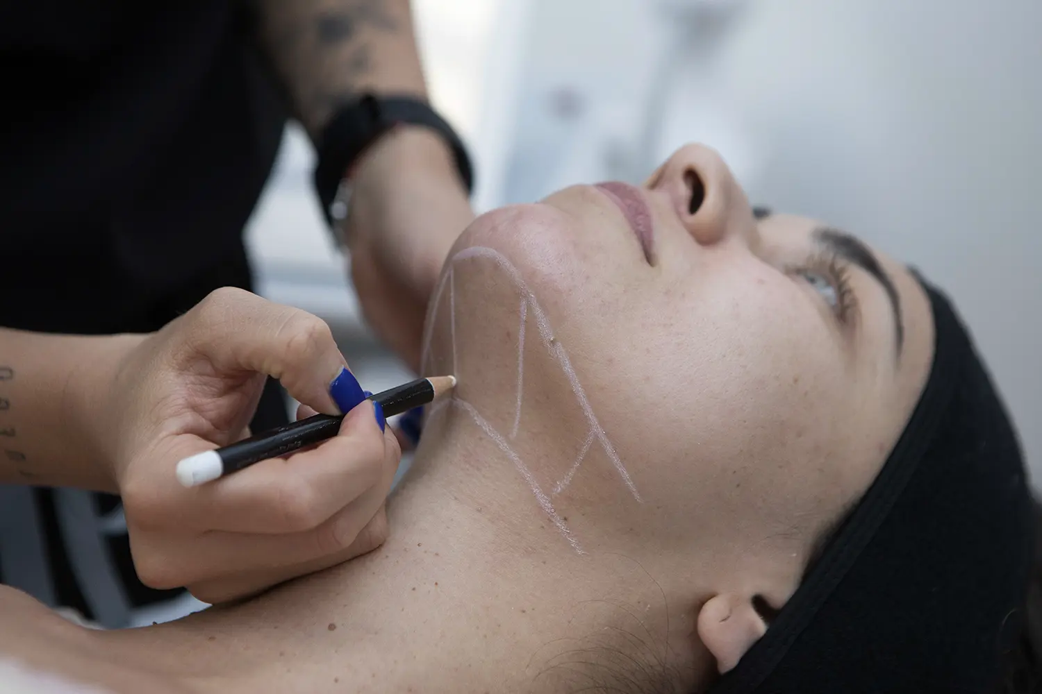 Tratamiento Para La Flacidez Facial 4 Flacidez Facial