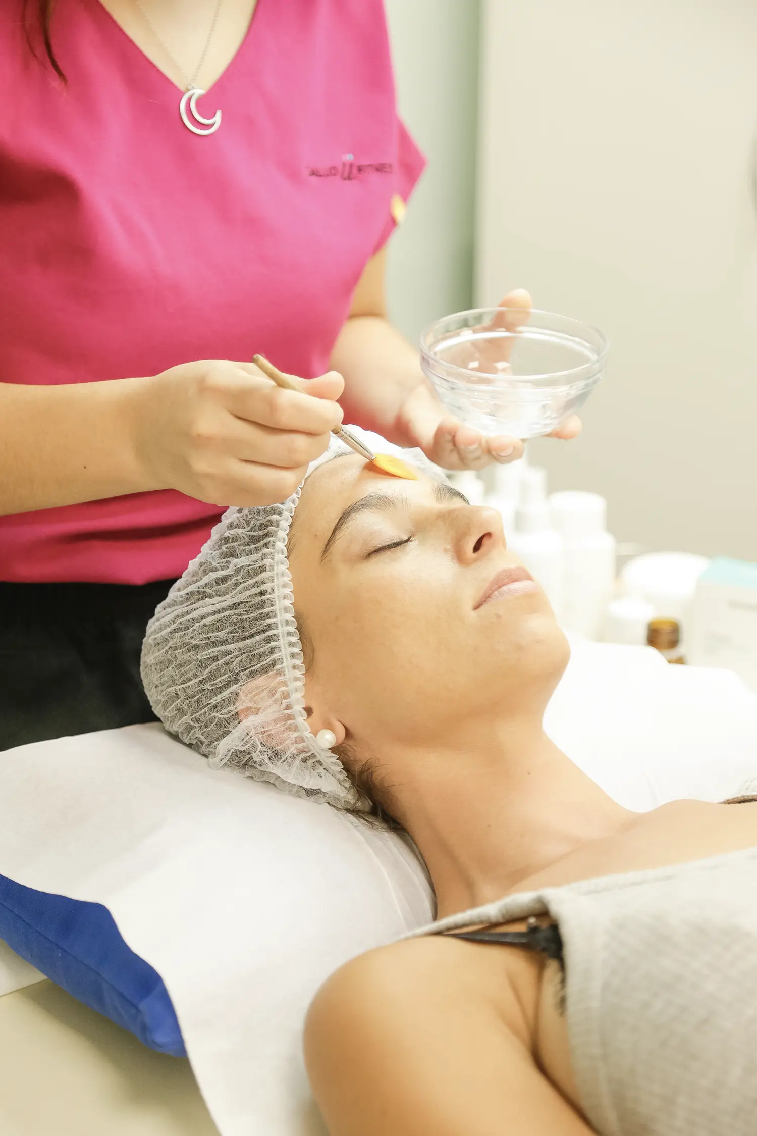 Tratamiento Secuelas Del Acné 1 Secuelas Del Acne