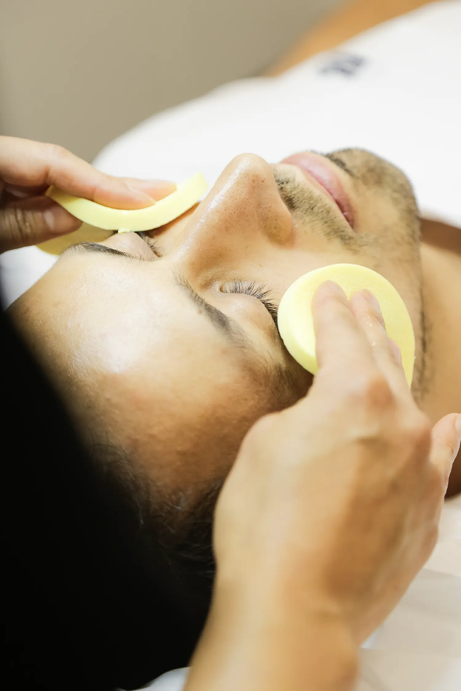 Tratamiento Anti Acne