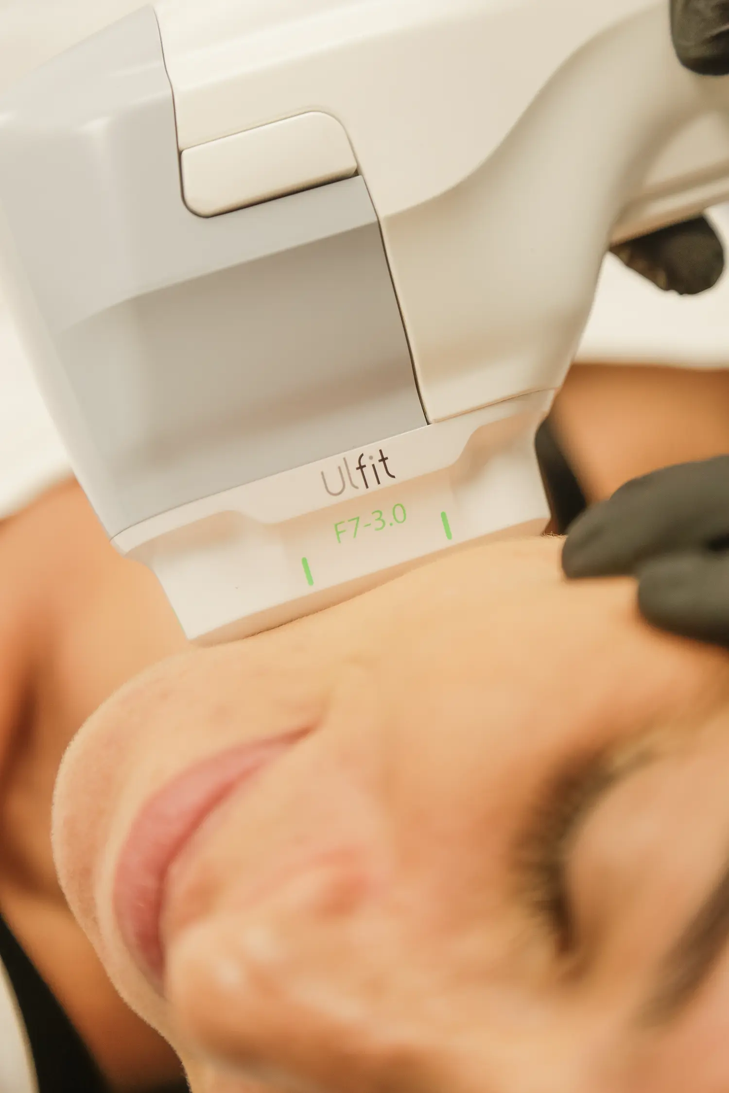 Hifu Facial