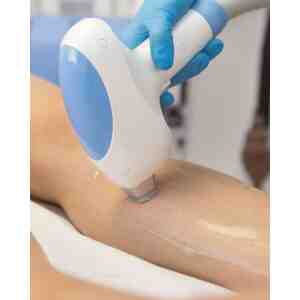 Depilacion Laser Piernas Completas, Rebaje Completo Y Axilas O Intergluteas