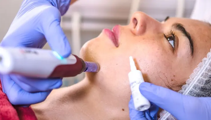 Tratamientos Faciales - Centro De Estetica Integral En Las Condes