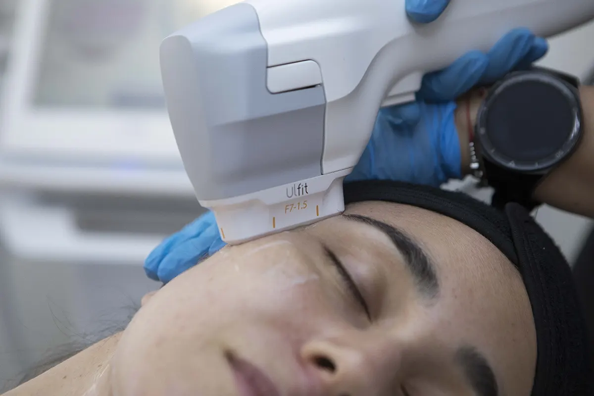 Tratamiento De Ojeras