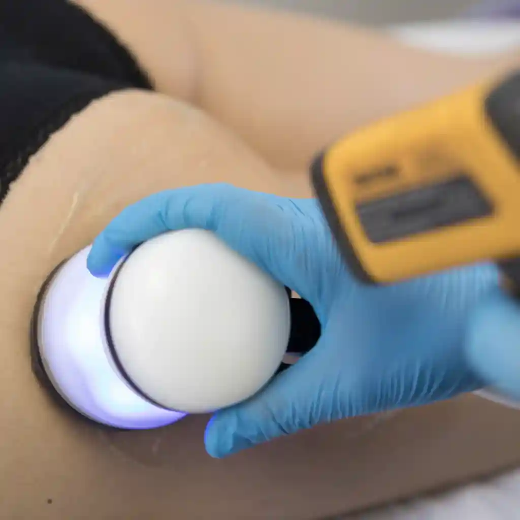 Cavitación Más Radiofrecuencia Con Masajes Modelantes