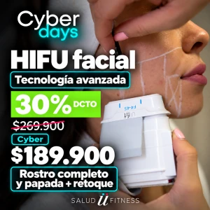 Depilación Láser Zona L A Elección (Mujer Y Hombre) 2 Hifu Rostro Completo Y Papada - Lifting Natural