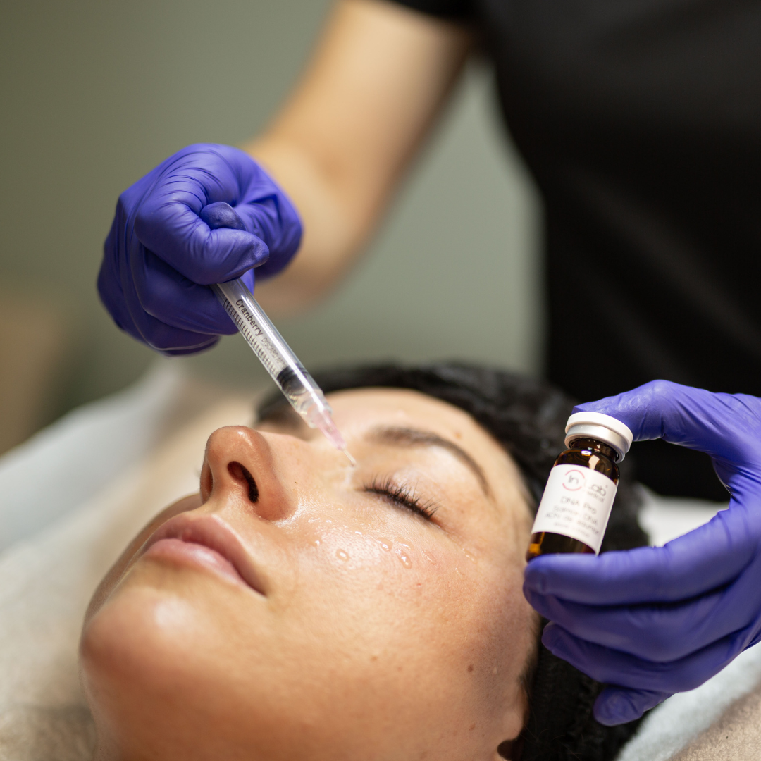 Rejuvenecimiento Facial 4 Rejuvenecimiento Facial - Centro De Estetica Integral En Las Condes