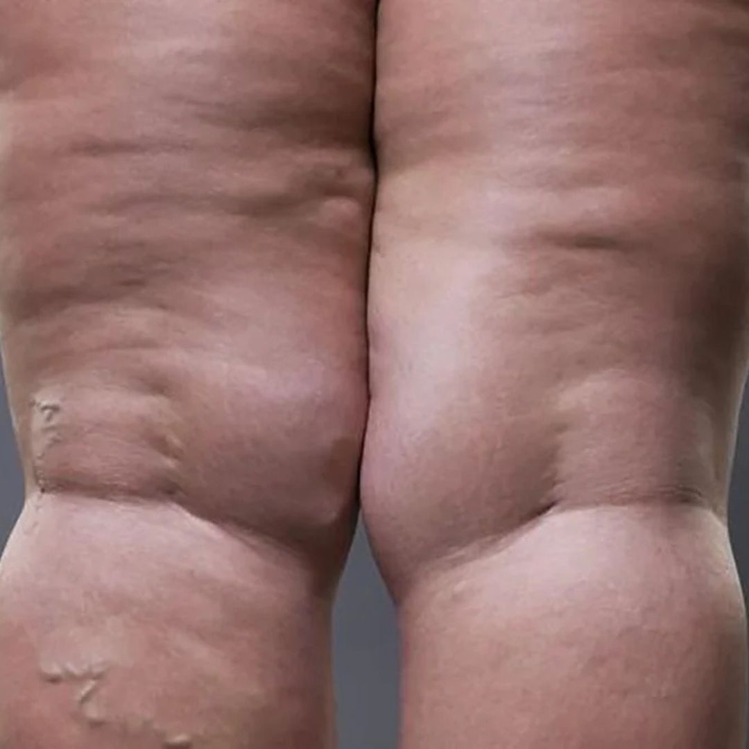 Otros Tratamientos 6 Otros Tratamientos - Centro De Estetica Integral En Las Condes
