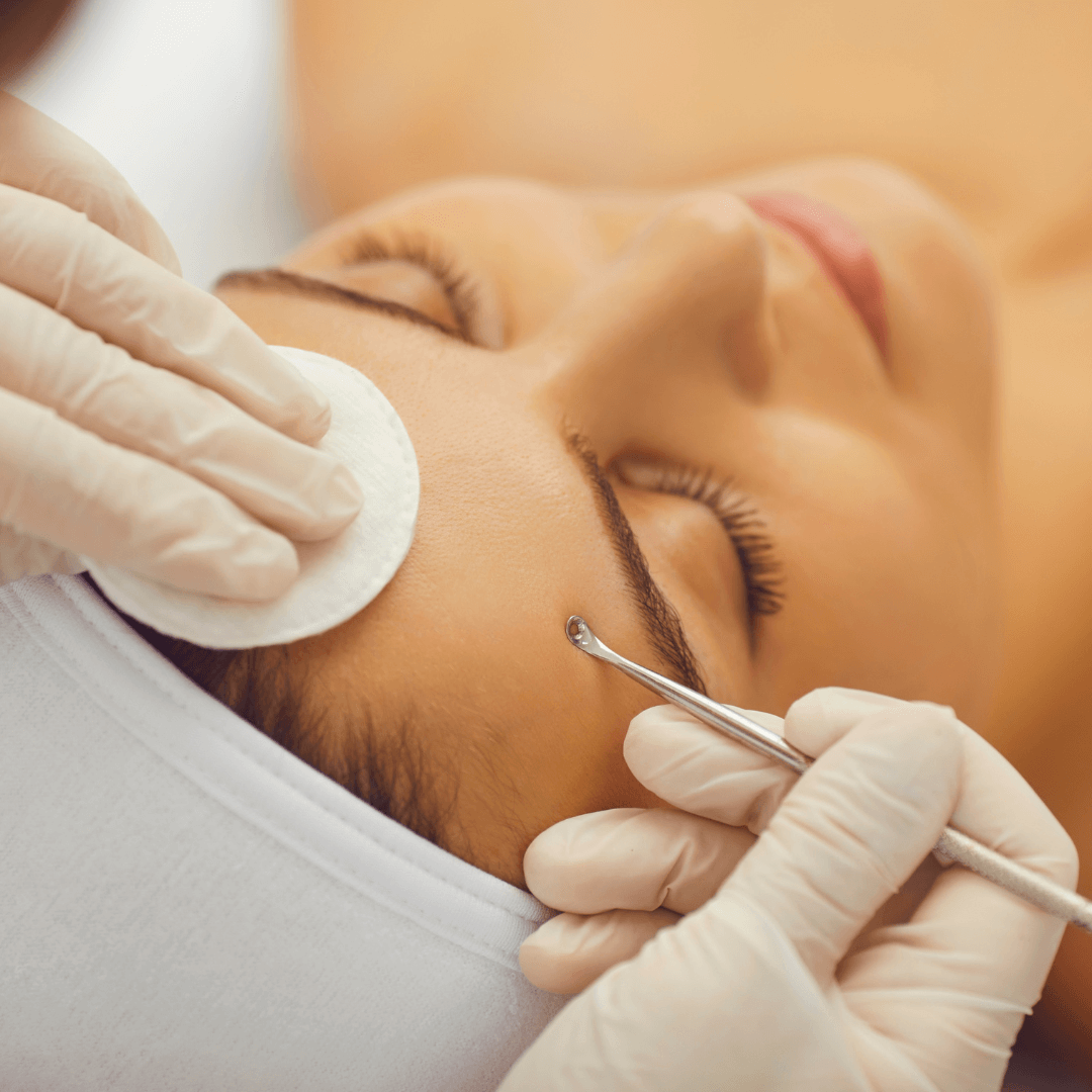 Tratamientos Faciales 4 Tratamientos Faciales - Centro De Estetica Integral En Las Condes