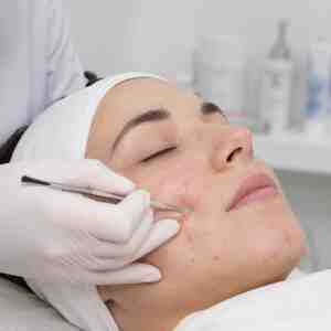 Limpieza Facial Profunda - Clínica Correctiva