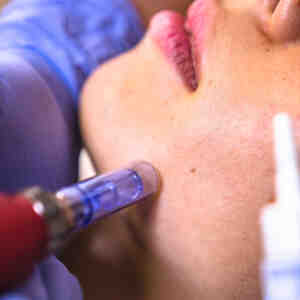 Limpieza Facial + Vitamin Recovery